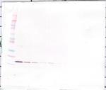 IL-1 beta Antibody in Western Blot (WB)