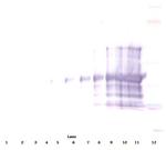 CD25 (soluble) Antibody in Western Blot (WB)