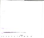 Eotaxin Antibody in Western Blot (WB)