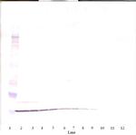 MIP-3 alpha Antibody in Western Blot (WB)