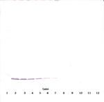 PPBP Antibody in Western Blot (WB)