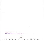 MCP-4 Antibody in Western Blot (WB)