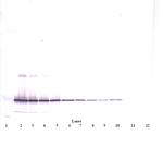 IL-11 Antibody in Western Blot (WB)