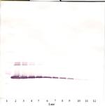 IL-2 Antibody in Western Blot (WB)