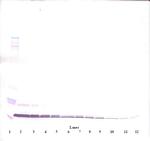 CXCL11 Antibody in Western Blot (WB)