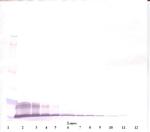 CXCL11 Antibody in Western Blot (WB)