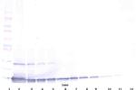 TECK Antibody in Western Blot (WB)