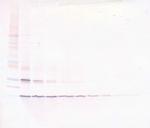 CD154 (CD40 Ligand) (soluble) Antibody in Western Blot (WB)