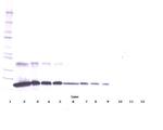 TNFR1 (soluble) Antibody in Western Blot (WB)