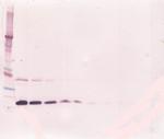 TNFR1 (soluble) Antibody in Western Blot (WB)