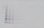 IL-15 Antibody in Western Blot (WB)