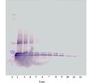 CD267 (TACI) Antibody in Western Blot (WB)