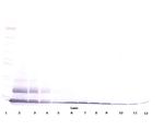 PROK1 Antibody in Western Blot (WB)