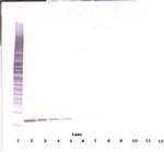 APRIL Antibody in Western Blot (WB)