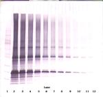 Adipolean variant Antibody in Western Blot (WB)