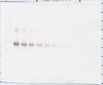 CD25 (soluble) Antibody in Western Blot (WB)