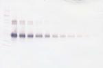 CD25 (soluble) Antibody in Western Blot (WB)