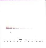 IGFBP7 Antibody in Western Blot (WB)