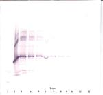 NOV Antibody in Western Blot (WB)