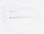 PAI1 Antibody in Western Blot (WB)