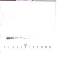 Endostatin Antibody in Western Blot (WB)