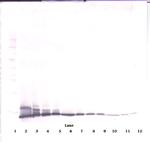 IL-2 Antibody in Western Blot (WB)