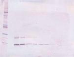 PTHLH Antibody in Western Blot (WB)