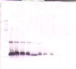 TIMP1 Antibody in Western Blot (WB)