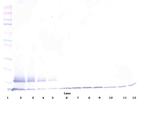 TRAIL-R2 (DR5) (soluble) Antibody in Western Blot (WB)