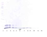 TRAIL-R2 (DR5) (soluble) Antibody in Western Blot (WB)