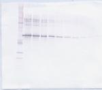 MMP2 Antibody in Western Blot (WB)