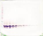 TFF2 Antibody in Western Blot (WB)