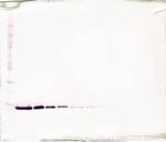 TFF2 Antibody in Western Blot (WB)