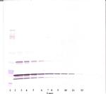 TNF beta Antibody in Western Blot (WB)