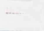 MMP3 Antibody in Western Blot (WB)