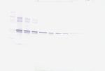 MMP3 Antibody in Western Blot (WB)