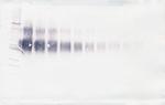 IL4R (soluble) Antibody in Western Blot (WB)