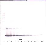 GM-CSF Antibody in Western Blot (WB)