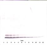 CCL5 (RANTES) Antibody in Western Blot (WB)