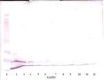 MCP-3 Antibody in Western Blot (WB)