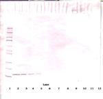 FLT3LG Antibody in Western Blot (WB)