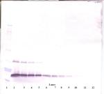 G-CSF Antibody in Western Blot (WB)