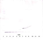 EGF Antibody in Western Blot (WB)