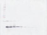 GM-CSF Antibody in Western Blot (WB)