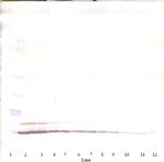 CCL5 (RANTES) Antibody in Western Blot (WB)