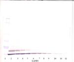 TARC Antibody in Western Blot (WB)