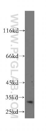 BCL10 Antibody in Western Blot (WB)