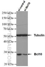 BCL10 Antibody in Western Blot (WB)