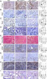 CD324 (E-Cadherin) Antibody in Immunohistochemistry (IHC)