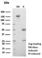 Langerin/CD207 (Marker of Langerhans Cells) Antibody in SDS-PAGE (SDS-PAGE)